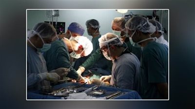 نجاح جراحة ميكروسكوبية بمستشفيات قنا الجامعية في إعادة طرف مبتور لمصاب