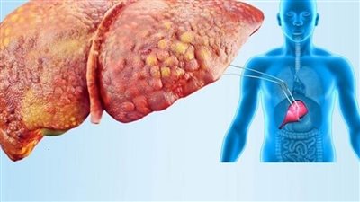 غدا.. المؤتمر السنوي للمعهد القومي للأمراض المتوطنة والكبد