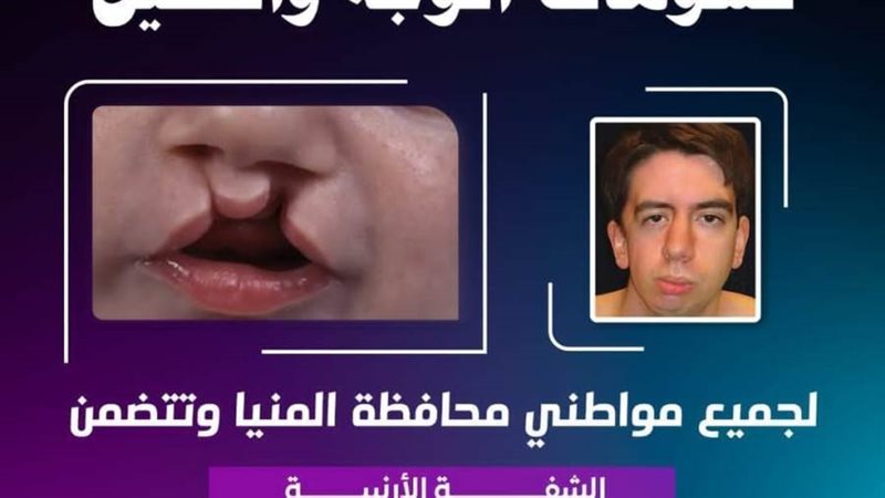 مبادرة علاج تشوهات