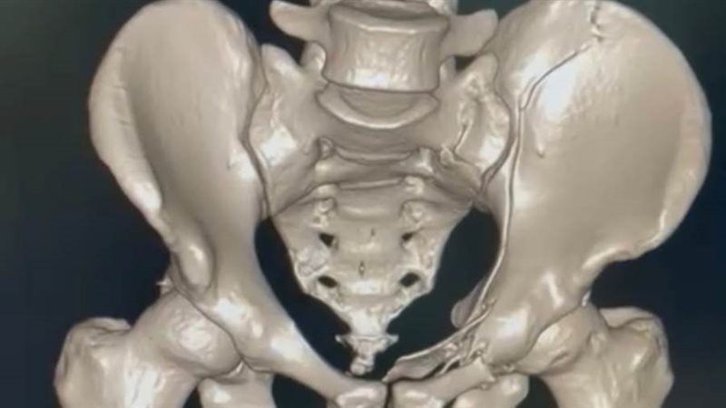 أشعة المريض