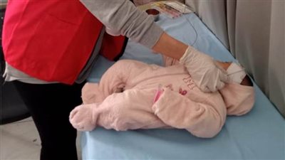 الصحة: فحص 3.85 مليون طفل بمبادرة الكشف المبكر وعلاج ضعف وفقدان السمع