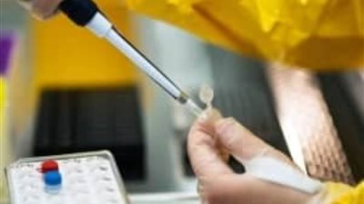 الأمم المتحدة ترفض إجراء تحقيق بشأن أنشطة البيولابس في المعامل البيولوجية بأوكرانيا