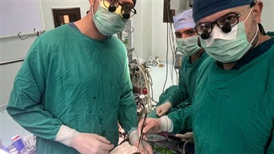 فريق طبى بجامعة أسيوط ينجح فى إنقاذ حياة سيدة أربعينية باستئصال ورم ضخم من القلب