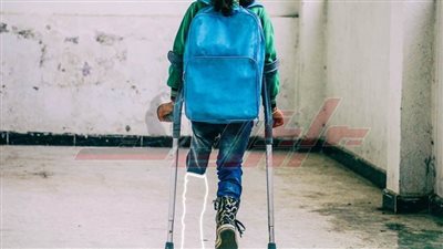 تسليم أجهزة تعويضية وأطرف صناعية في قرى ومراكز كفر الشيخ