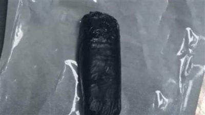 استخراج هاتف محمول من معدة مريض بمستشفى المنصورة الدولي 