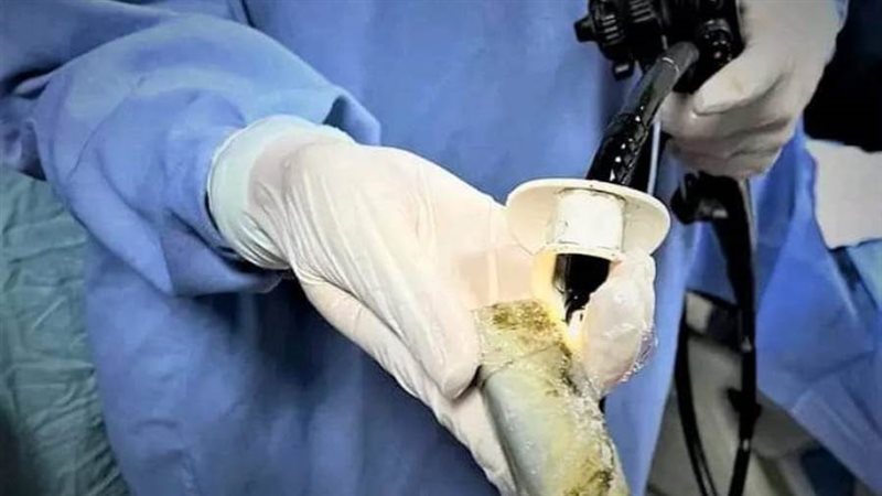 استخراج الهاتف