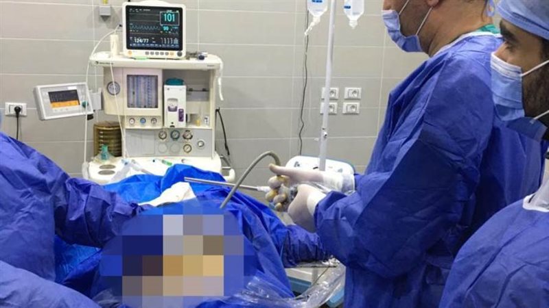 إجراء 64 عملية جراحية