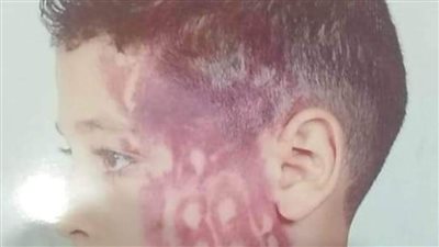 تعليم الدقهلية: لا تهاون في حق التلميذ المعتدى عليه بالمطرية