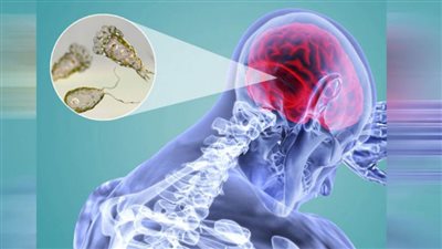 الصحة الماليزية :لم يتم الإبلاغ عن أي حالات إصابة بالأميبا آكلة الدماغ
