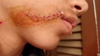 طالب يتعدى على زميله بسبب رفض تغشيشه بشبين القناطر 