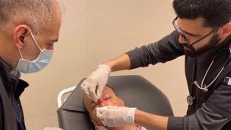 إصابة عضو بثوري فتح