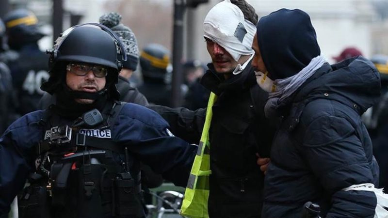 مصابي الشرطة الفرنسية