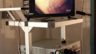 افتتاح عيادة أمراض الجهاز الهضمي والكبد والمناظير بمستشفى الدلنجات