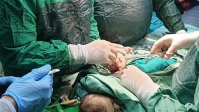 جراحة عاجلة لطفلة عمرها عامان  