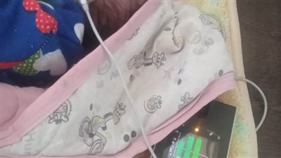 فحص 11 ألف طفل حديث الولادة بالمنيا ضمن 