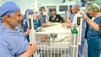 نجاح فصل التوأم السيامي النيجيري 