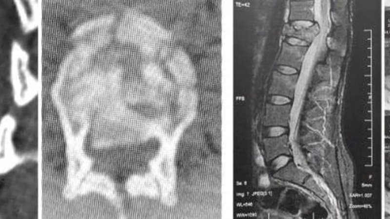 عملية معقدة
