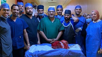 فريق طبي بمعهد جنوب مصر للأورام بجامعة أسيوط ينجح في استئصال ورم ضخم يزن (30) كيلو جراما من الرحم