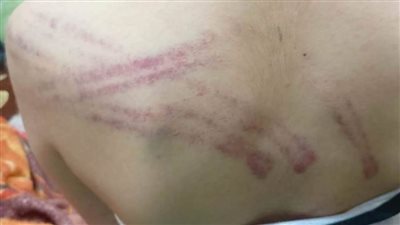 ولى أمر طالبة يحرر محضرًا ضد معلمة لتعديها على نجلته في درس خصوصي بشبين القناطر