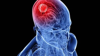 عاجل| دراسة تكشف عن 