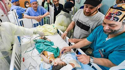 نجاح فصل التوأم السيامي السوري 