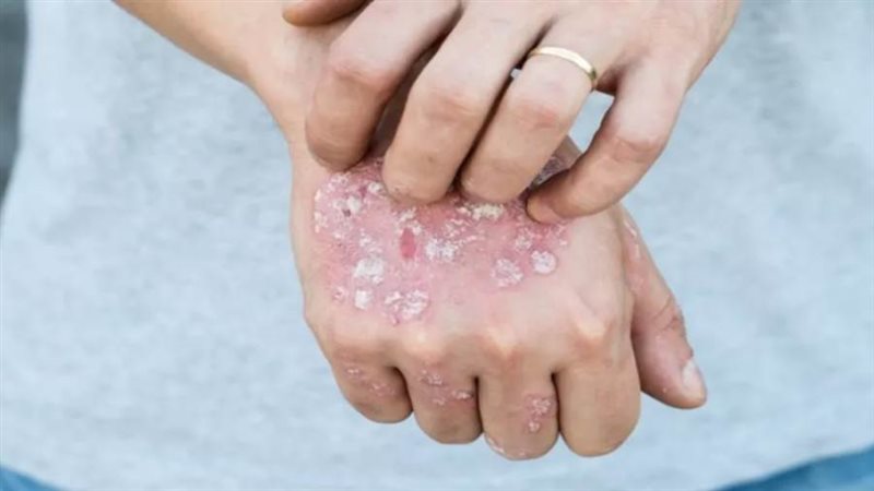 الإصابة بالأمراض