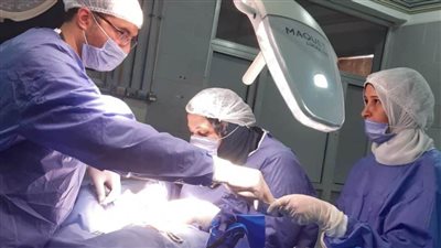 إجراء جراحة انسداد معوي لأول مرة بمستشفى أجا بالدقهلية