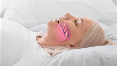 انقطاع النفس الانسدادي النومي قد يزيد مخاطر الإصابة بأمراض القلب والأوعية الدموية