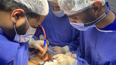 إجراء أول عملية جراحية لاستئصال الغضروف القطني بمستشفى أبوحماد بالشرقية 