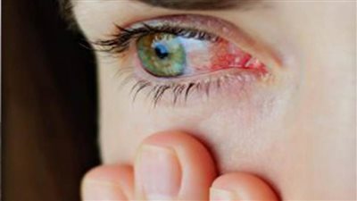 دراسة حديثة: أضرار خطيرة تلحق بالبصر بسبب ارتفاع درجات الحرارة 