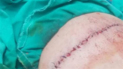 استدعاء مدرس لتعديه على ولي أمر طالب بمدرسة في شبرا الخيمة