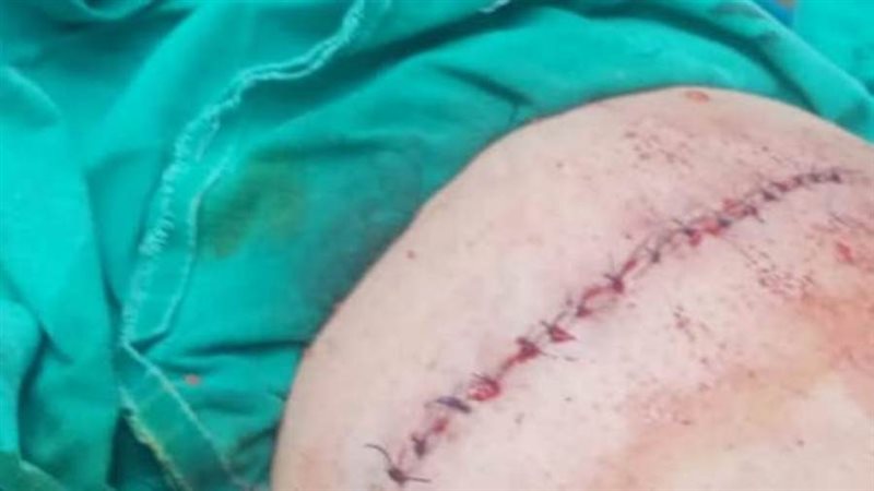 إصابة ام الطالب