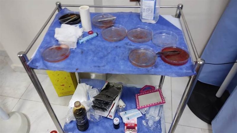 المركز المضبوط