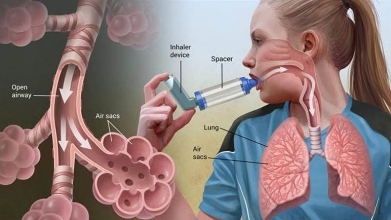 الربو الشعبى