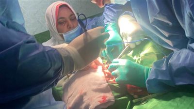 أطباء مستشفى الدلنجات ينجحون فى إزالة ورم نادر برقبة مريض