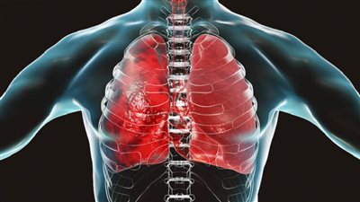 دراسة أمريكية تتوصل إلى سبب الالتهاب الرئوي الفطري