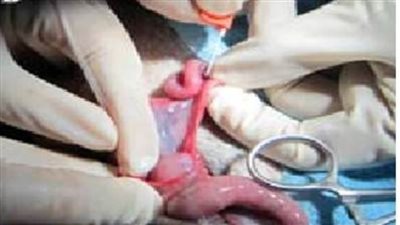 عاجل.. جريمة الكيان الصهيوني في حق 