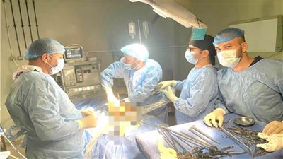 إجراء عملية ذات مهارة بإصلاح انفجار في قرحة بالمعدة بمستشفى بالبحيرة 