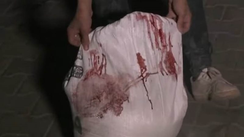 مساعدات بطعم الدم