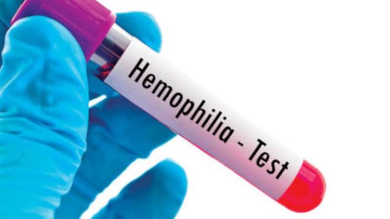 اعراض مرض الهيموفيليا