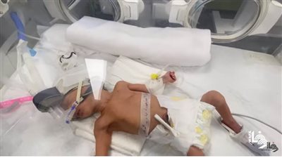 عاجل| صابرين الروح.. طفلة 