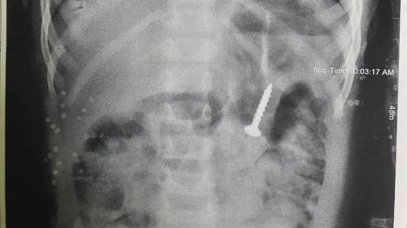 الجسم تحت الأشعة