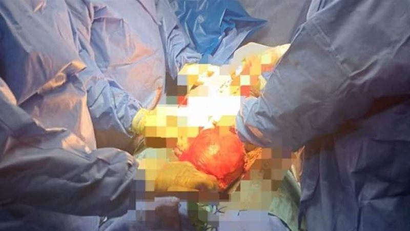 الفريق الطبى بمستشفى