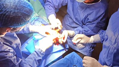 لأول مرة بالبحيرة.. إجراء عملية جراحية دقيقة لشاب يعاني من بتر