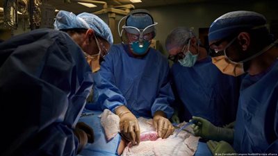 الصين تجري أول عملية زراعة كبد خنزير في العالم لإنسان باستخدام التعديل الجيني