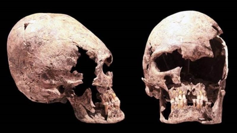 جمجمة مصري قديم