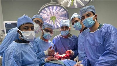 فريق طبي بمستشفى سوهاج الجامعي ينقذ ذراع سيدة من البتر 