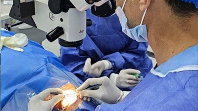 نجاح زراعة قرنية بالتقنية المتقدمة لمريضة بمستشفى الرمد بصحة الإسكندرية