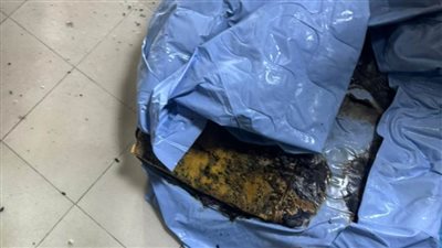  بالصور.. السيطرة على حريق محدود بمستشفى طوارئ جامعة طنطا