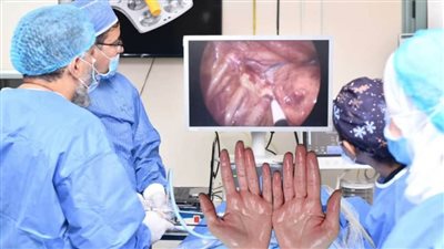 الأولى من نوعها.. استخدام تقنية المنظار الجراحي لعلاج فرط التعرق في مبرة التأمين الصحي بالغربية